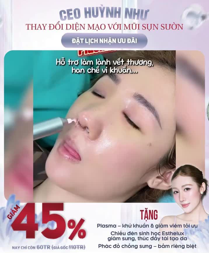 CEO HUỲNH NHƯ "LỘT XÁC" DIỆN MẠO – BÙNG NỔ ƯU ĐÃI NÂNG MŨI SỤN SƯỜN GIẢM NGAY 45%