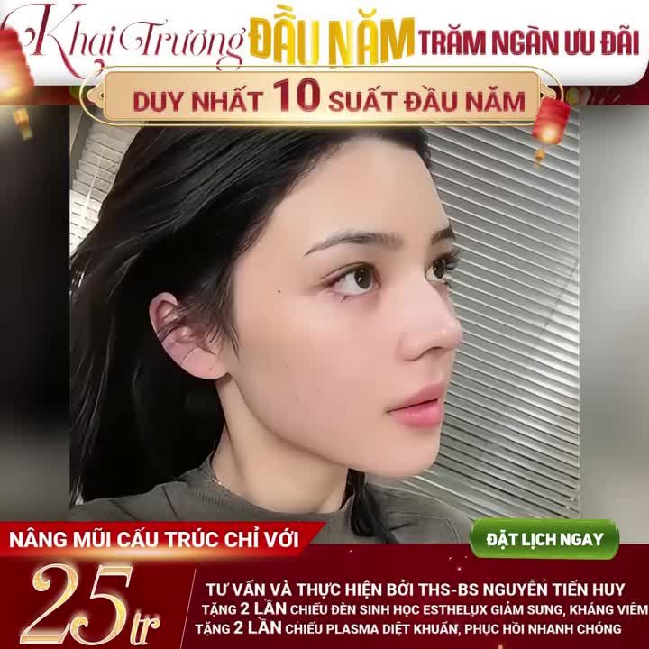 LÌ XÌ ĐẦU NĂM – TRĂM NGÀN QUÀ TẶNG: KHAI XUÂN RẠNG RỠ VỚI MŨI CẤU TRÚC CHỈ 25TR