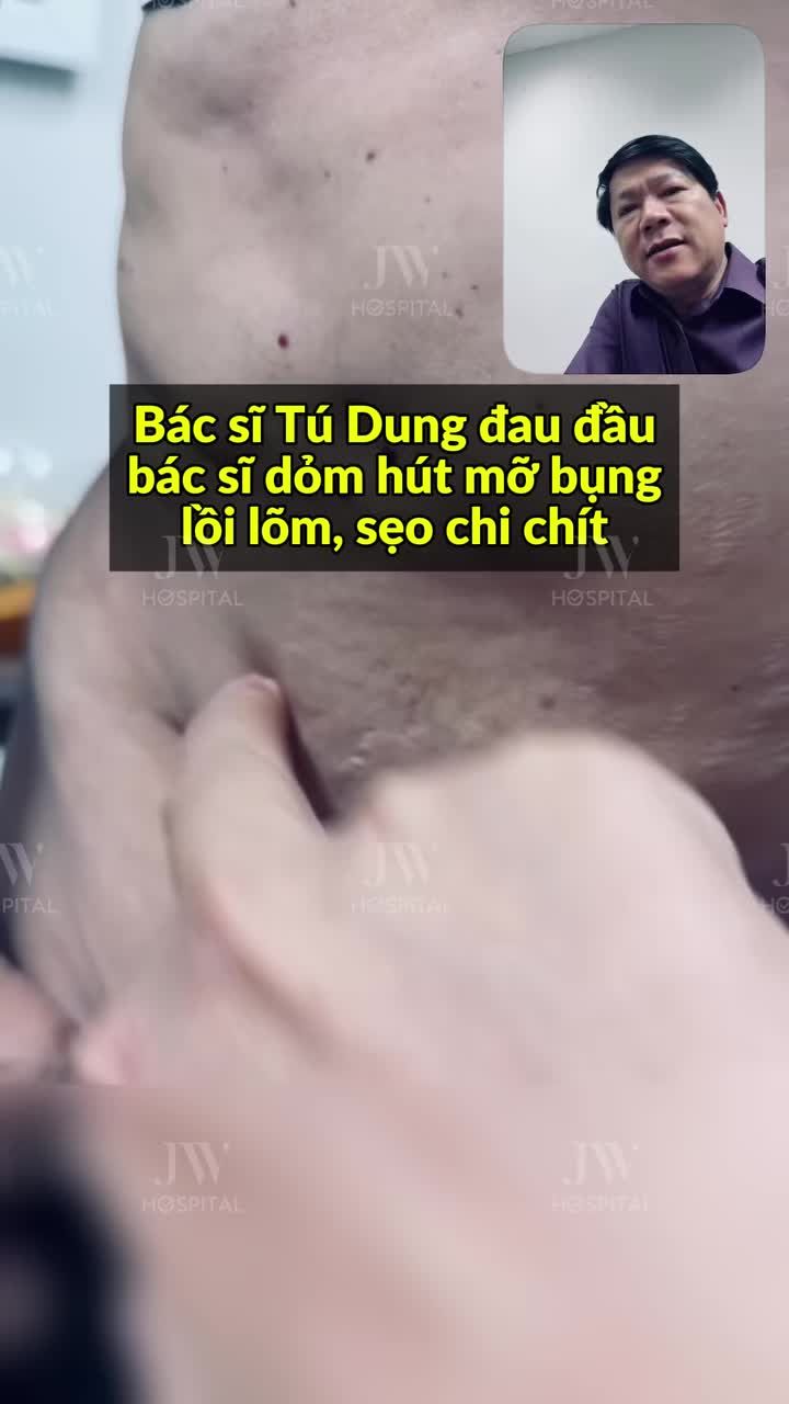 BÁC SĨ TÚ DUNG ĐAU ĐẦU BÁC SĨ DỎM HÚT MỠ CHUI KHIẾN BỤNG KHÁCH LỒI LÕM, SẸO CHI CHÍT