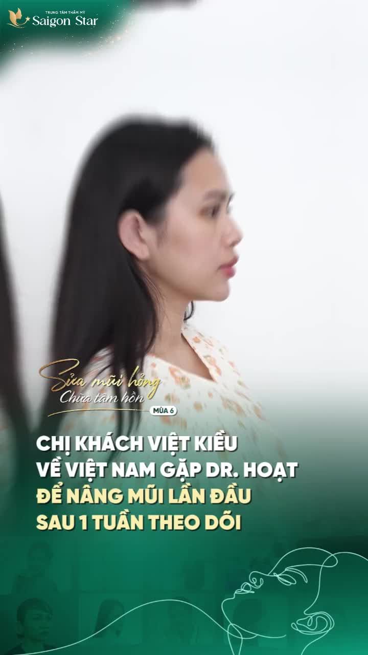 VỀ VIỆT NAM CHỐT ĐƠN DÁNG MŨI CHỈ SAU 1 TUẦN FOLLOW BÁC SĨ HOẠT