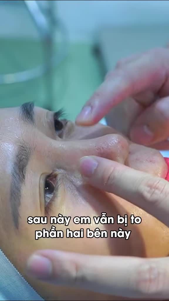 Đây là điều mình gặp rất nhiều khi tư vấn.