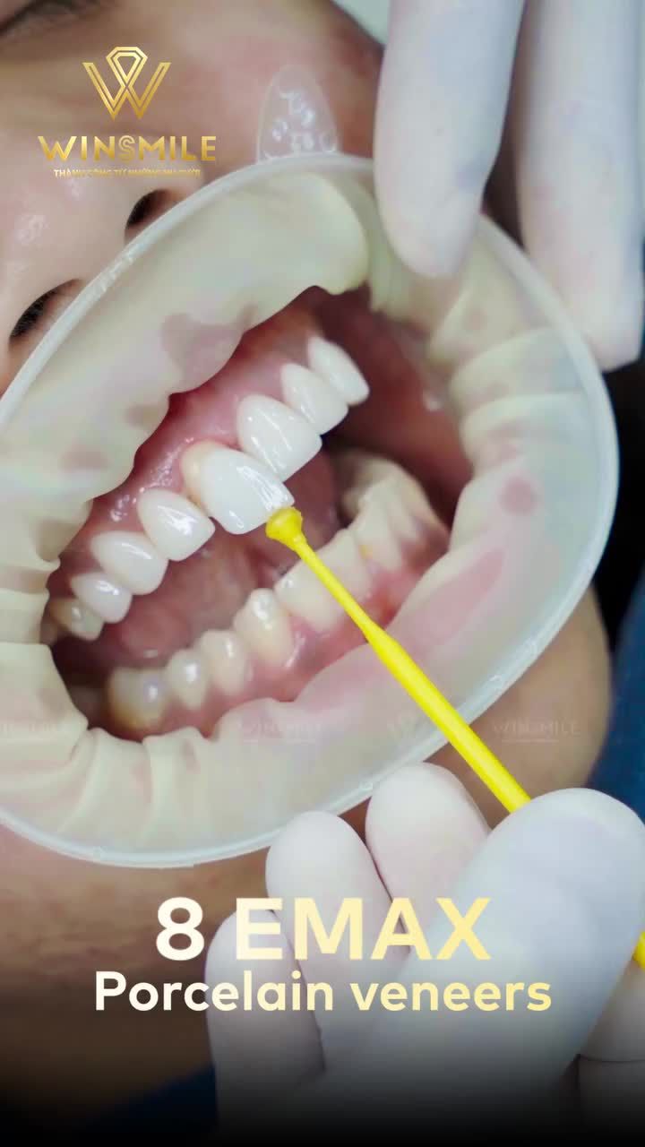 Là một khách hàng ngoại quốc, cô gái Philippines - Zee Dugenia   từng nghĩ sẽ có những bỡ ngỡ khi làm răng ở một đất nước xa lạ.