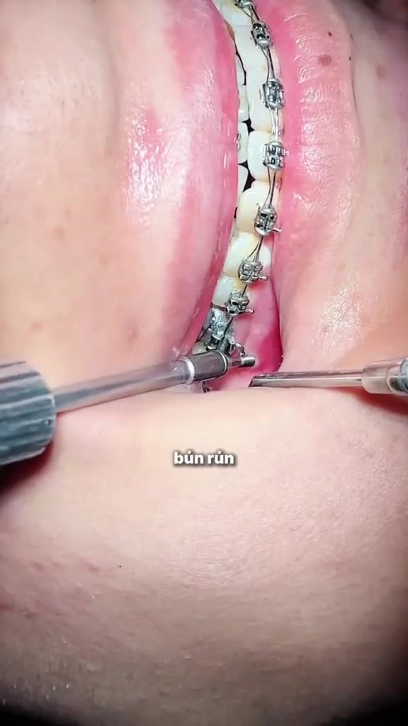 Có trải qua cơn mộng mộng này chưa?