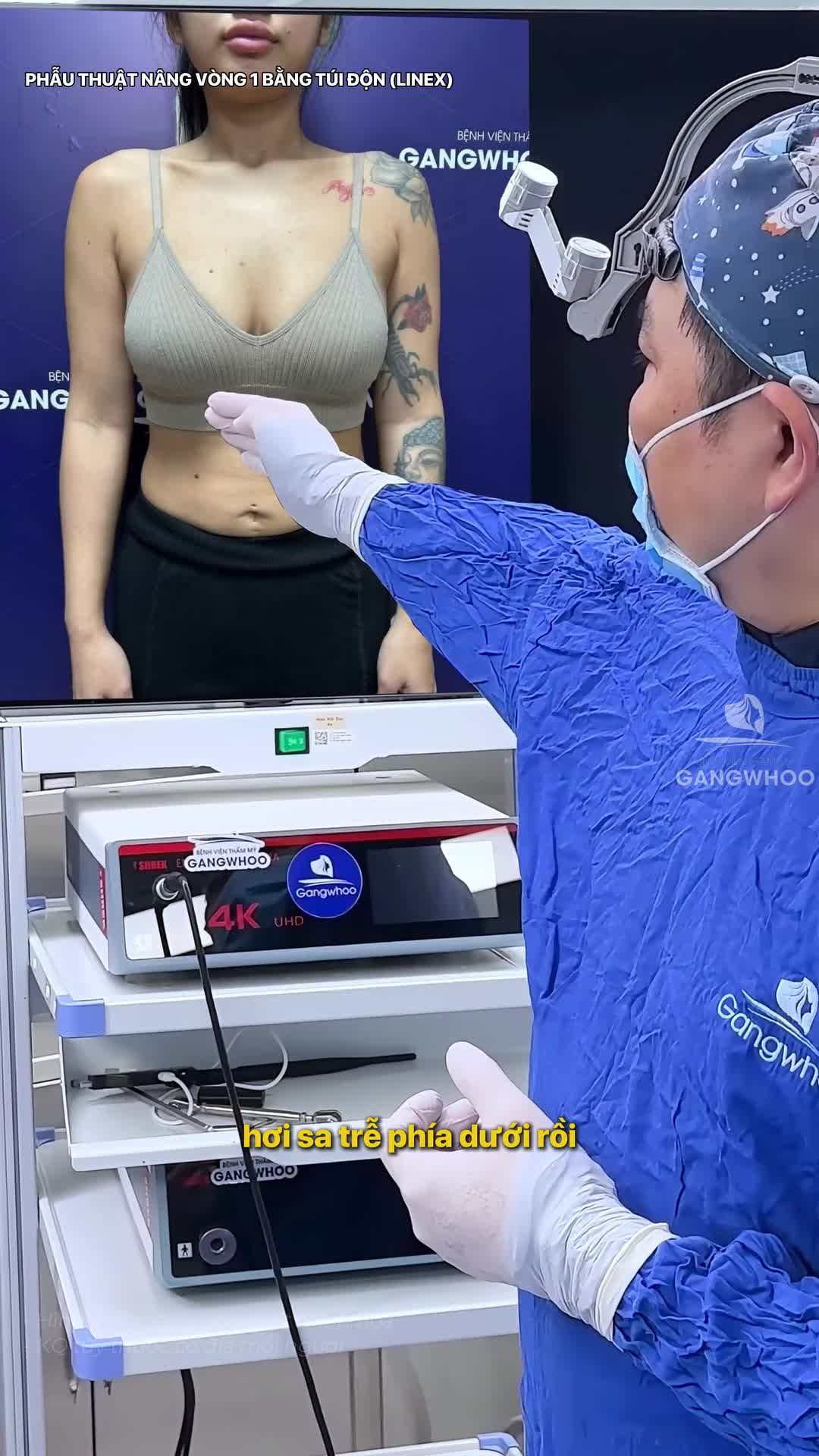 Khách hàng GenZ chỉ mới 19 tuổi nhưng vòng 1 đã sa trễ ở cấp độ 2. Sau nhiều lần đắn đo, suy nghĩ, cô nàng đã đưa ra quyết định là lựa chọn BVTM Gangwhoo để nâng vòng 1 của mình