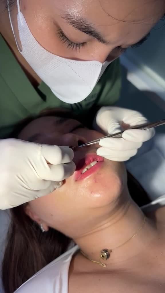 Chị gái 9X Việt kiều Mỹ lên đời diện mạo chuẩn hoa hậu đầu xuân sau thực hiện NÂNG MŨI S LINE 3D tại JW