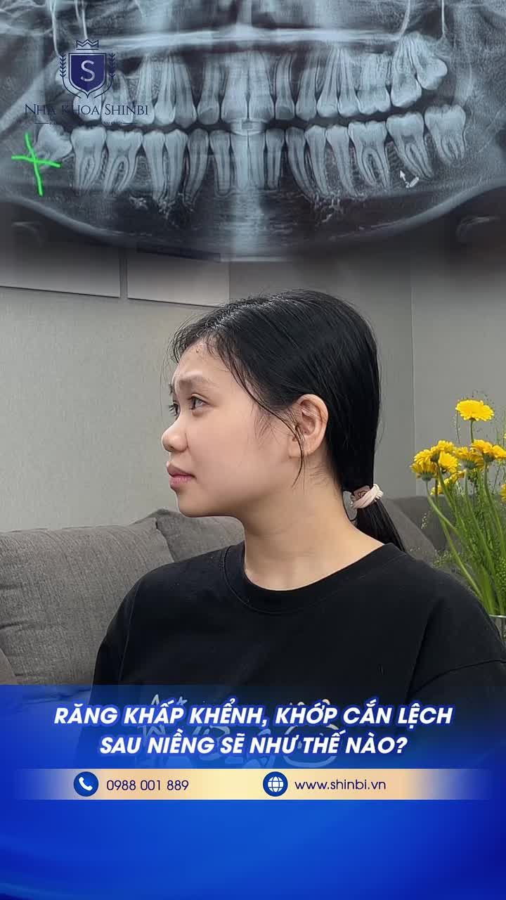 NIỀNG RĂNG CÓ ĐAU KHÔNG, ĂN TỐT KHÔNG?