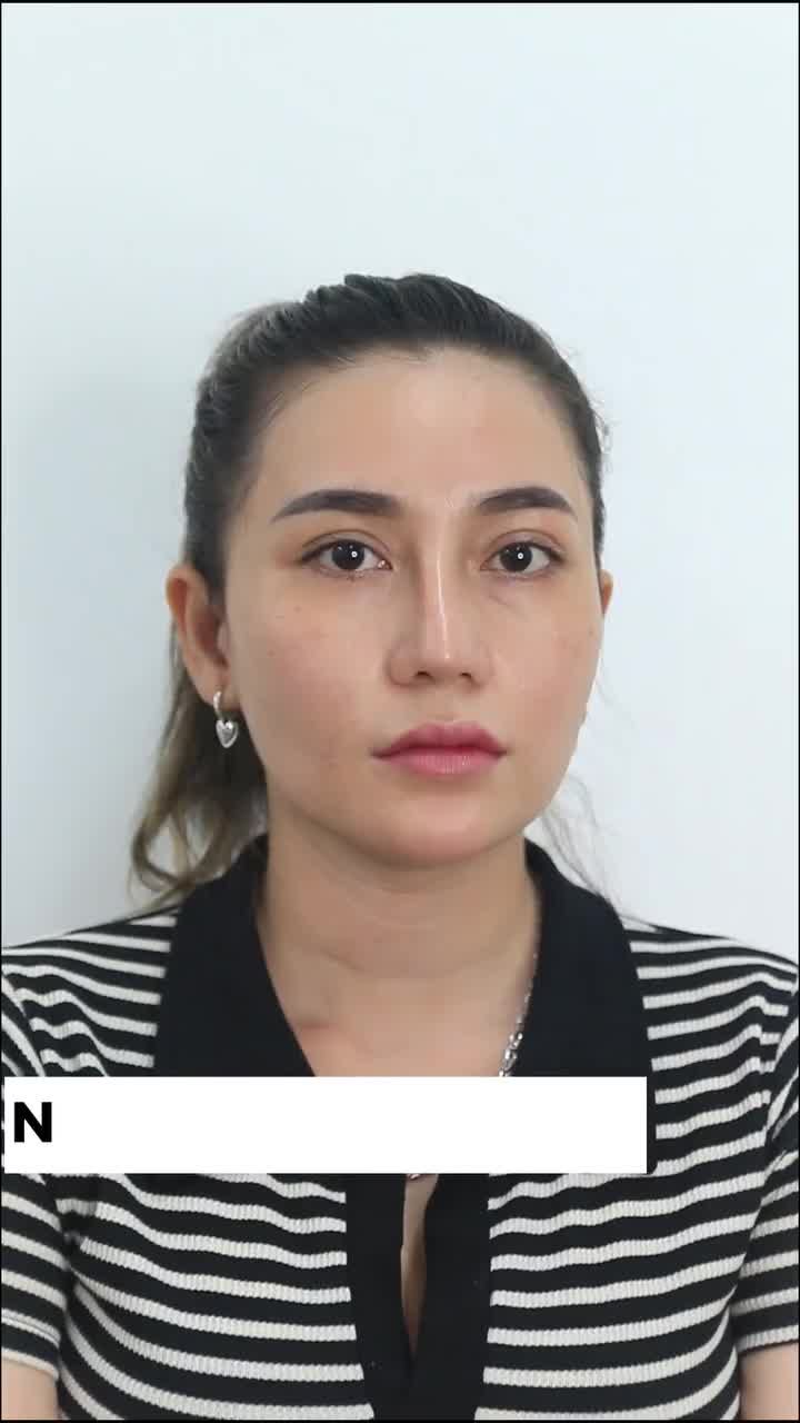 Hi vọng để rồi thất vọng sau khi nâng mũi - đây là cảm giác mà cô ấy đã trải qua.