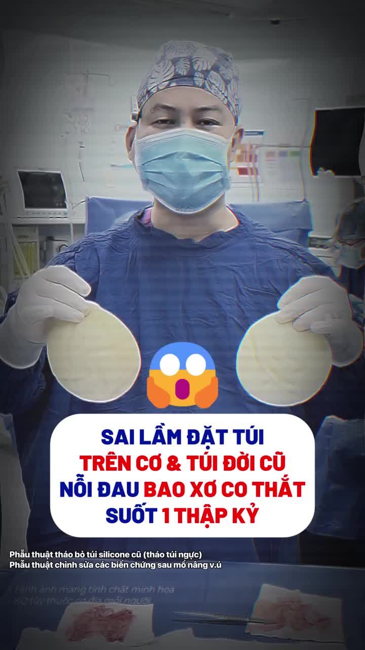 Chị khách hàng đến từ Australia tìm tới Gangwhoo với tình trạng bao xơ, co thắt nghiêm trọng sau khi đã đặt túi n.gực cách đây 10 năm.