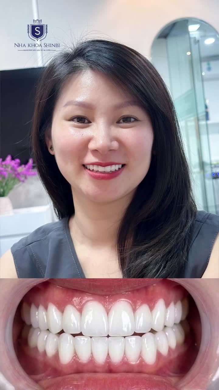 RĂNG SỨ THẨM MỸ - NỤ CƯỜI HẠNH PHÚC