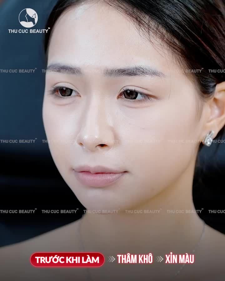 Tạm biệt môi thâm – Đón môi xinh chuẩn thần thái