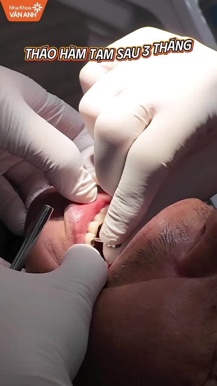 SỰ TẬN TÂM TRONG TỪNG ĐIỂM CHẠM CUỐI CÙNG