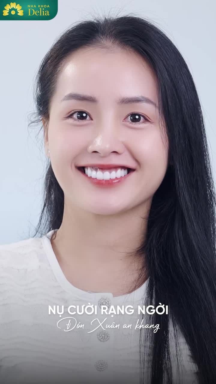 Bạn sẽ đẹp như thế nào sau Thẩm mỹ Răng Sứ?