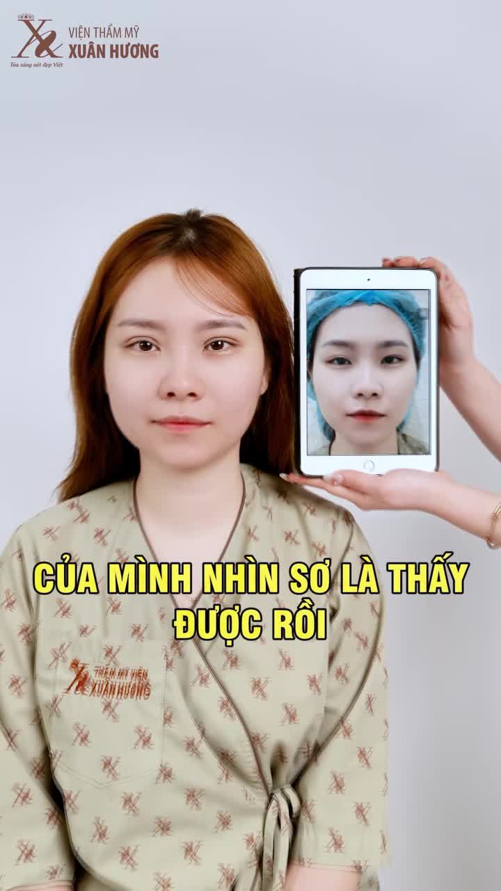 “MẮT 2 MÍ MÀ PHẢI NHÌN KỸ MỚI THẤY HẢ? CỦA MÌNH NHÌN SƠ LÀ THẤY ĐƯỢC RỒI!”