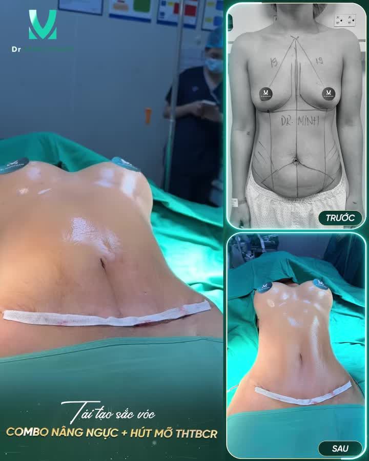 RESET VÓC  DÁNG – NÂNG TẦM BODY