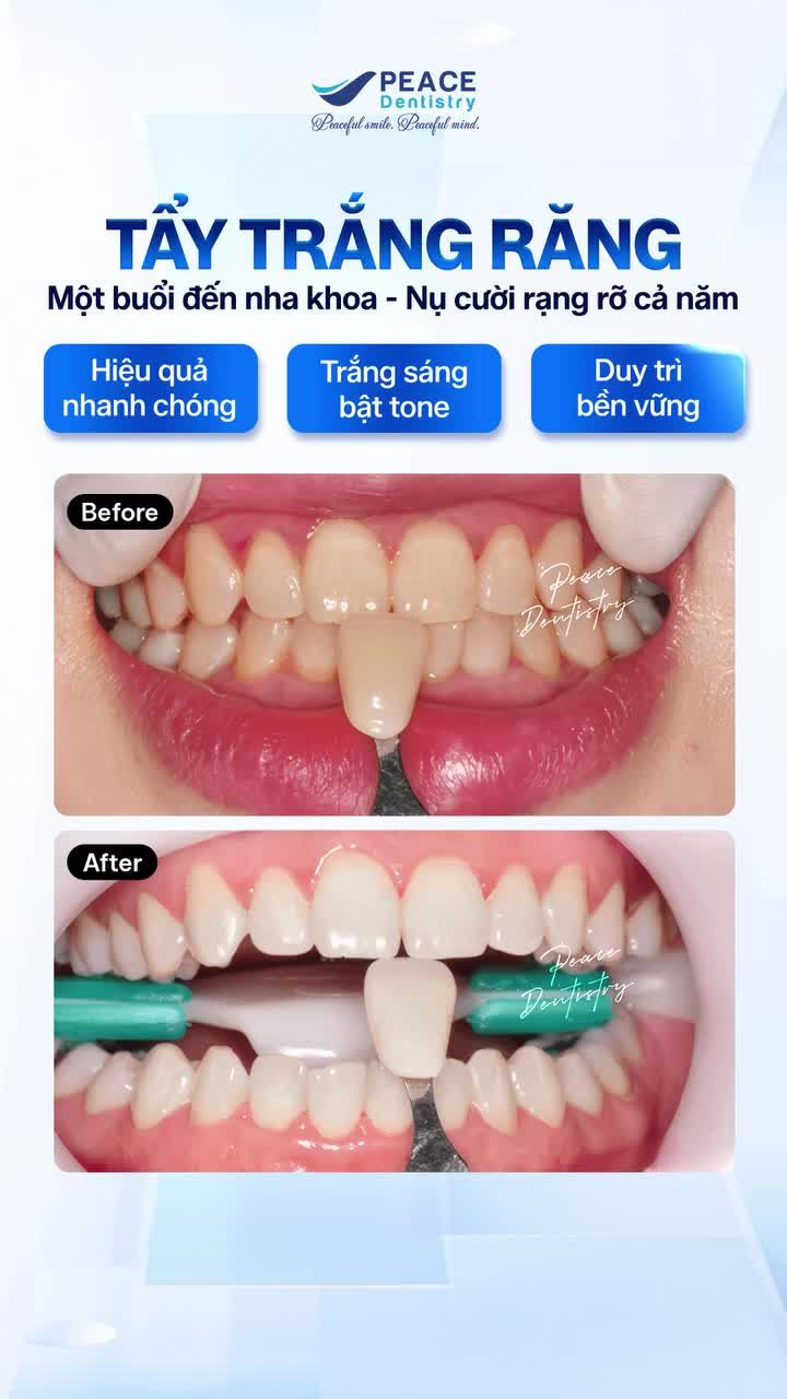 Đã đến lúc Tân trang nụ cười - Sẵn sàng đón Tết