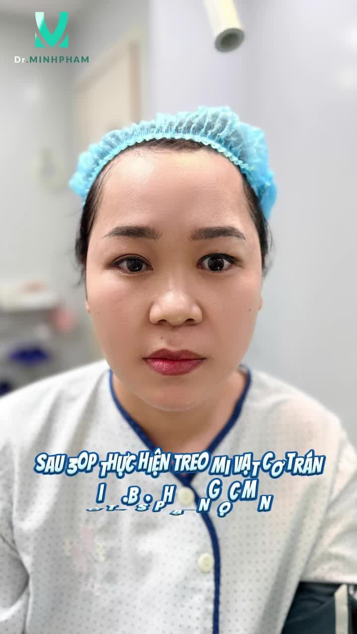 THAY ĐỔI RÕ RỆT SAU 1 THÁNG
