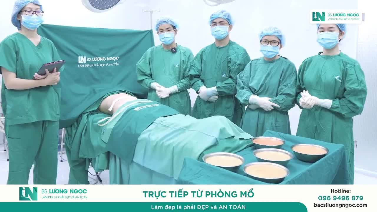 HÚT MỠ TẠO DÁNG BỤNG – SIẾT EO KẾT HỢP CẤY MỠ TỰ THÂN