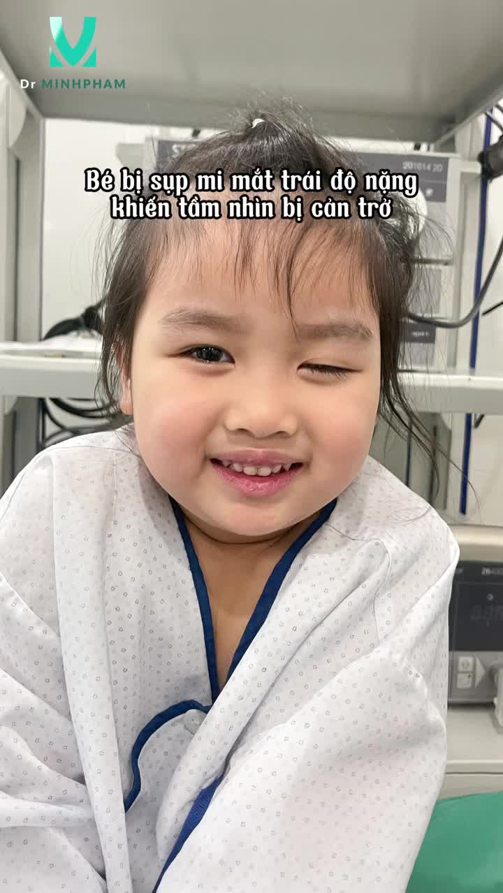 Tình trạng trước, đôi mắt sụp mi khiến bé Khánh Ngân luôn tự ti, ngại giao tiếp. Và gia đình đã lựa chọn Dr. Minh Phạm để thực hiện phương pháp treo mi bằng vạt cơ trán