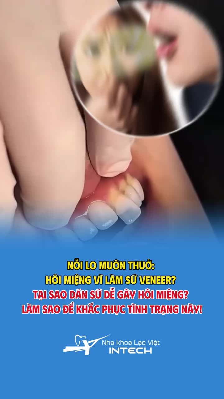 Cần lưu ý những điều gì trước khi làm dán sứ veneer để không xảy ra tình trạng hôi miệng?