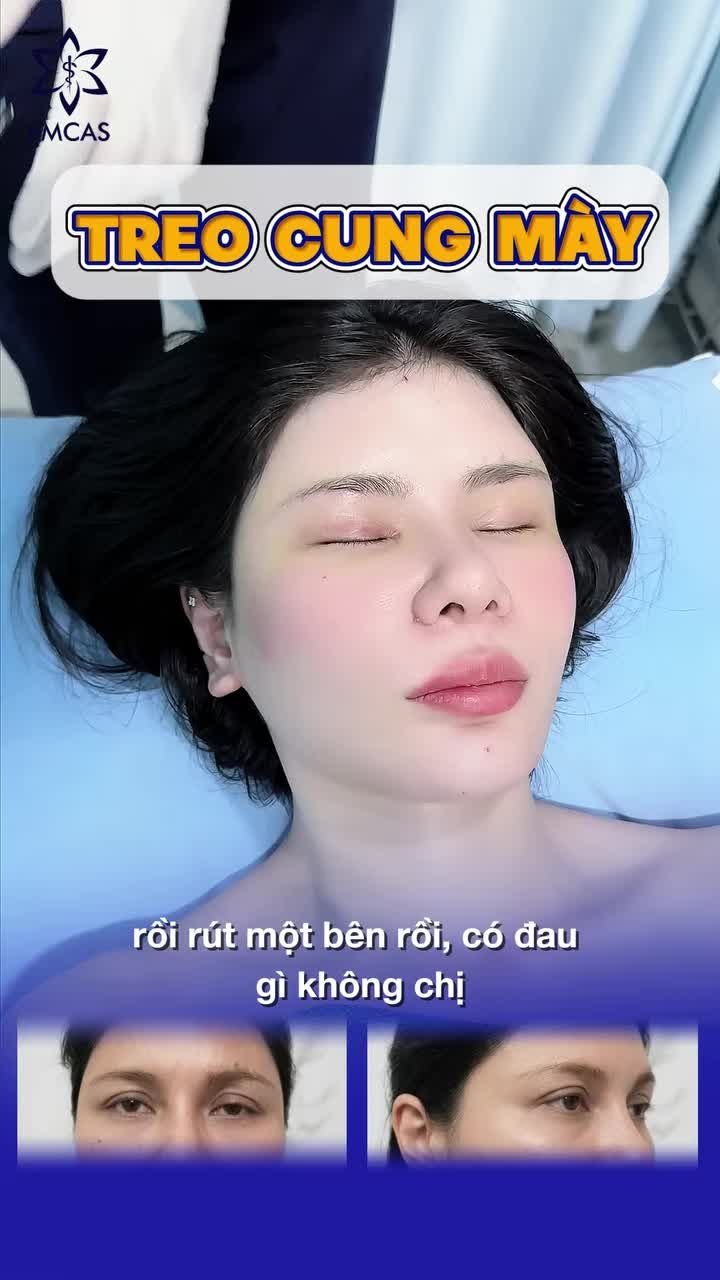 Khách quay lại EMCAS sau 4 năm