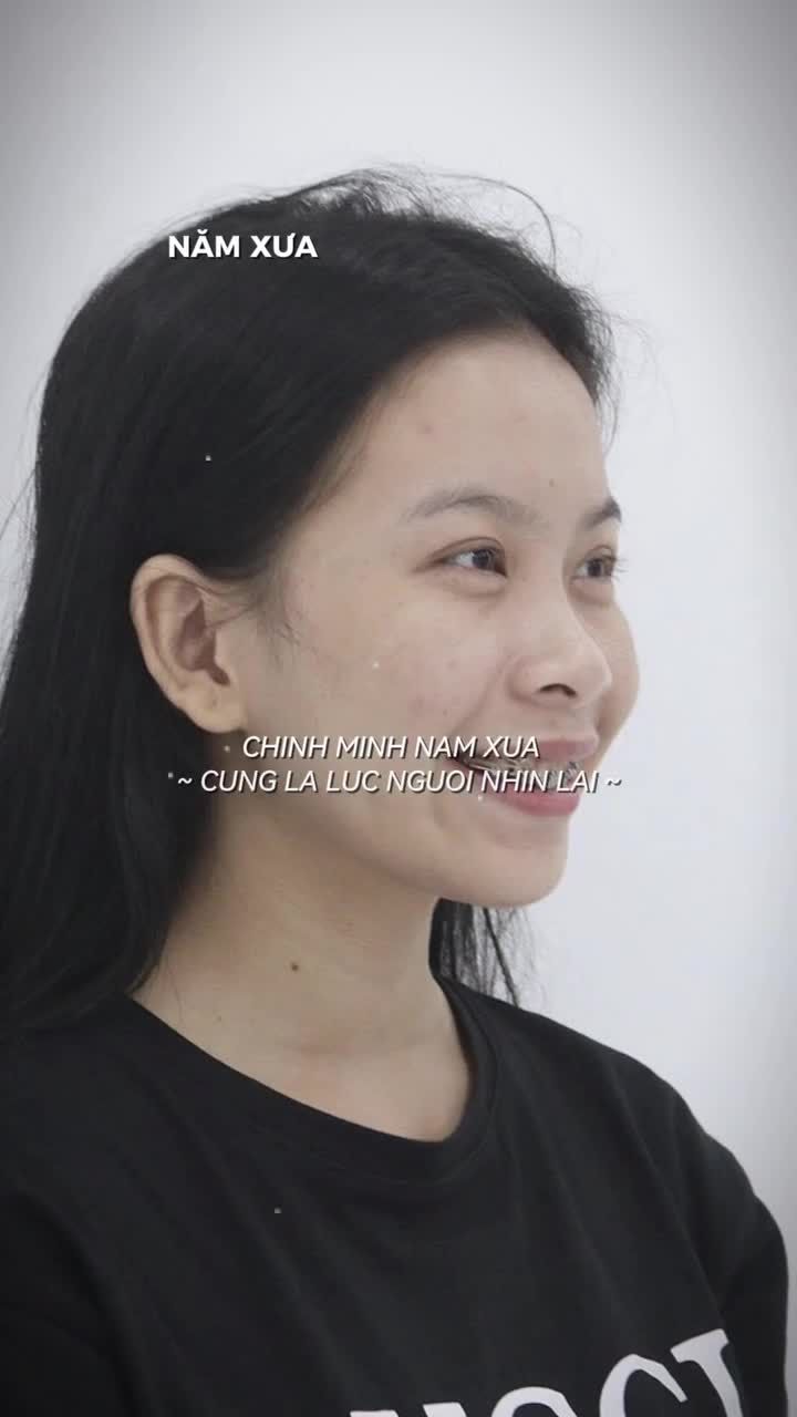 TẠM BIỆT RĂNG HÔ - TỰ TIN "SHOW" NỤ CƯỜI TRÊN SÂN KHẤU