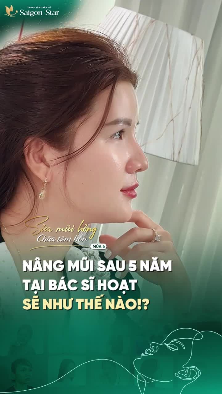 NÂNG MŨI TẠI BÁC SĨ HOẠT SAU 5 NĂM SẼ NHƯ THẾ NÀO??? SẼ NGÀY CÀNG ĐẸP VÀ NHUẬN SẮC HƠN CHỨ SAO NỮA