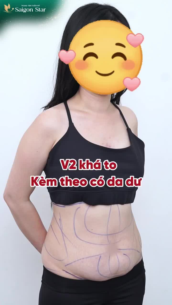 3 TUẦN CHO MÀN "LỘT XÁC" VÓC DÁNG