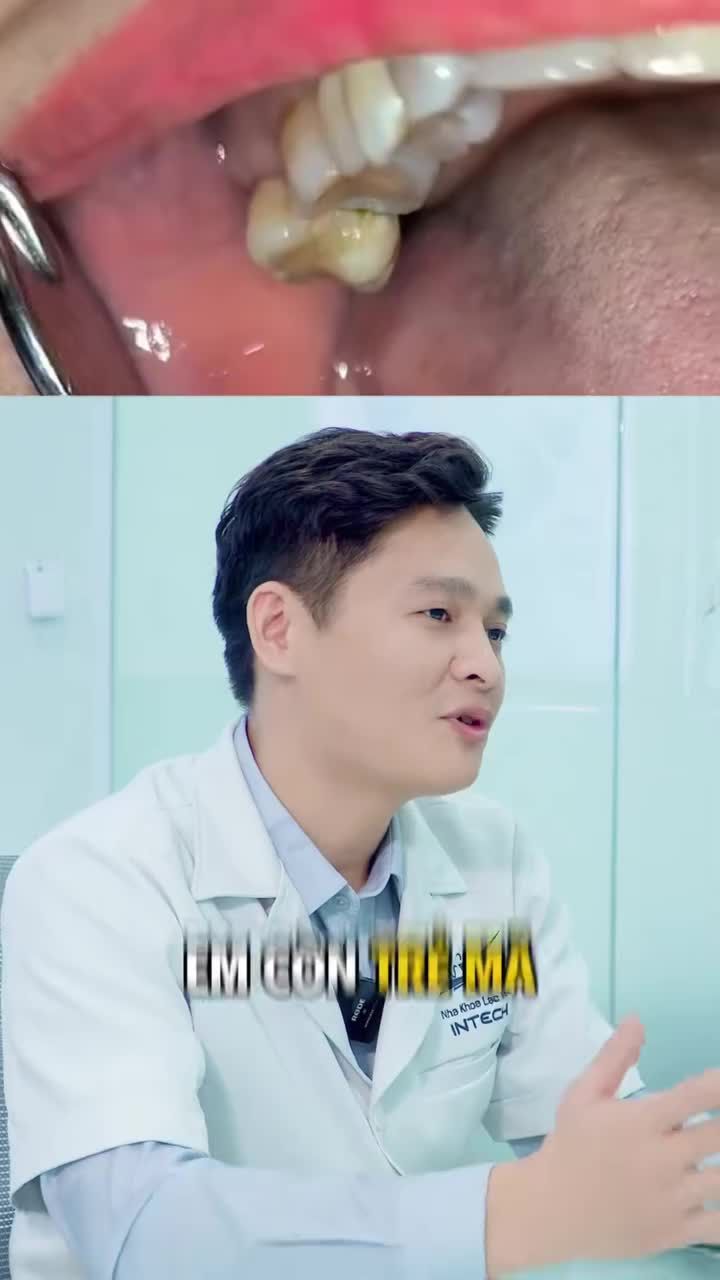 Hậu quả mất răng khi răng đối trồi xuống