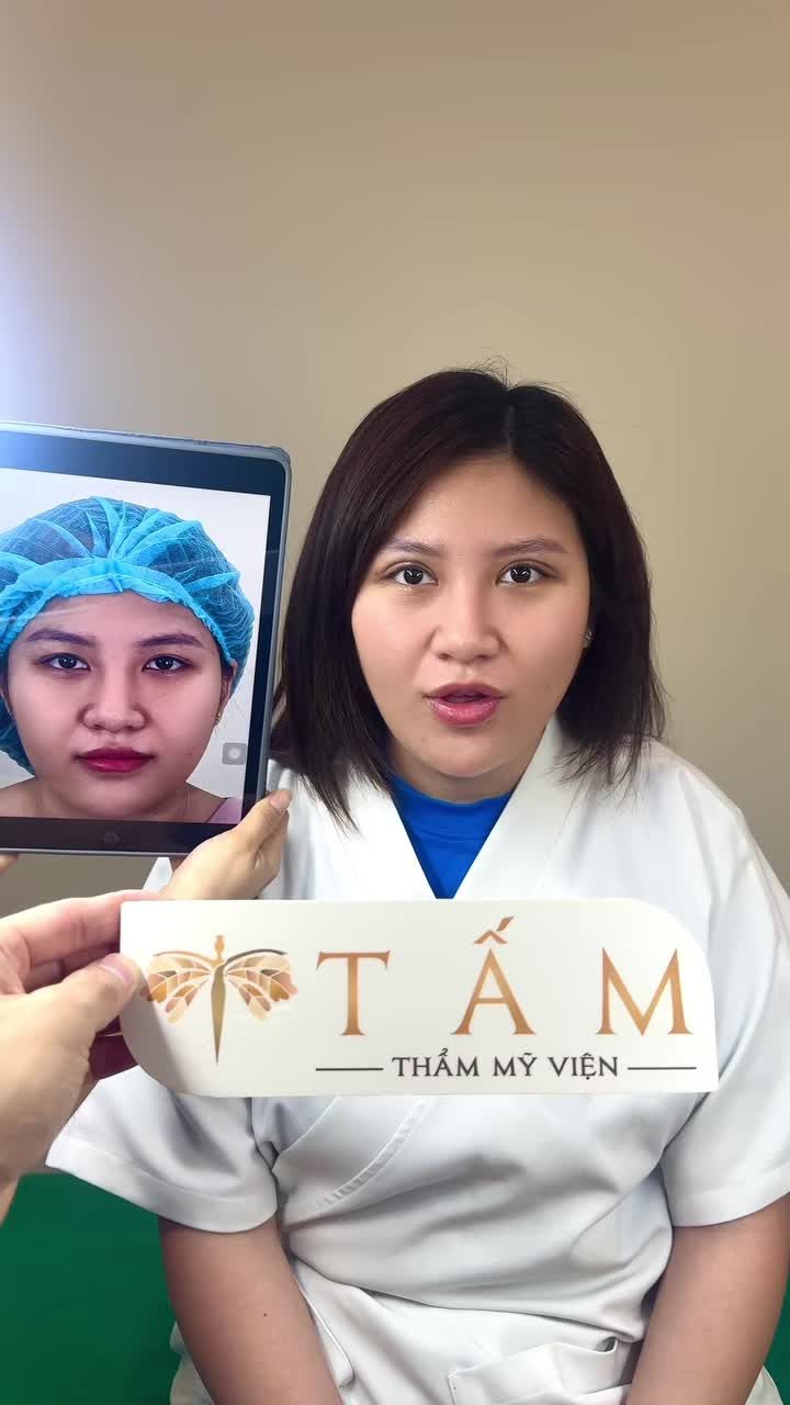 Bạn khách qua tái khám và cắt chỉ sau 7 ngày thực hiện dịch vụ cắt mí. Cảm ơn bạn đã lựa chọn Thẩm mỹ viện Tấm để gửi gắm nhan sắc.