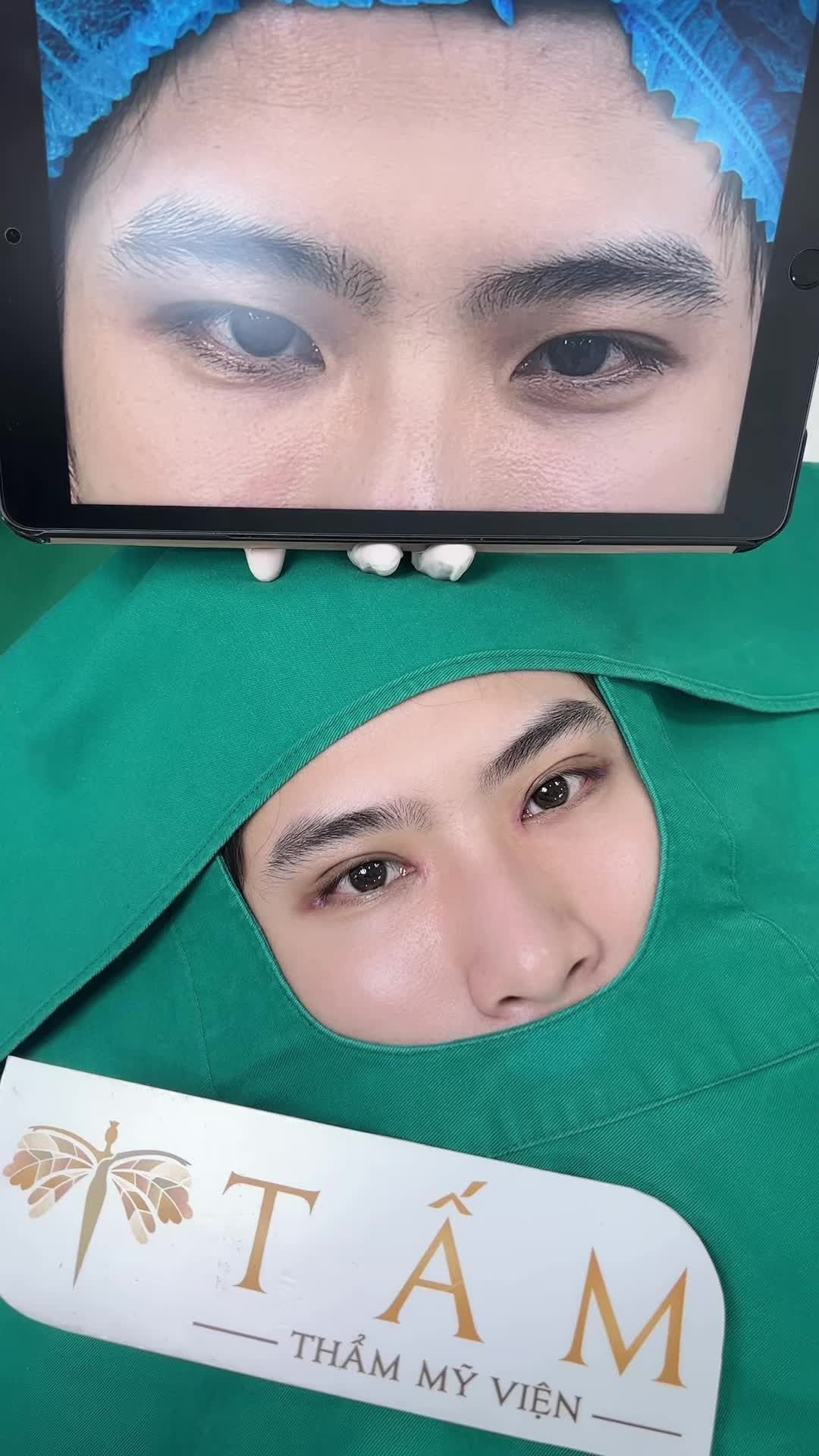 Cùng TMV Tấm chiêm ngưỡng mí mắt 9 ngày tuổi của bạn khách nam nhé!