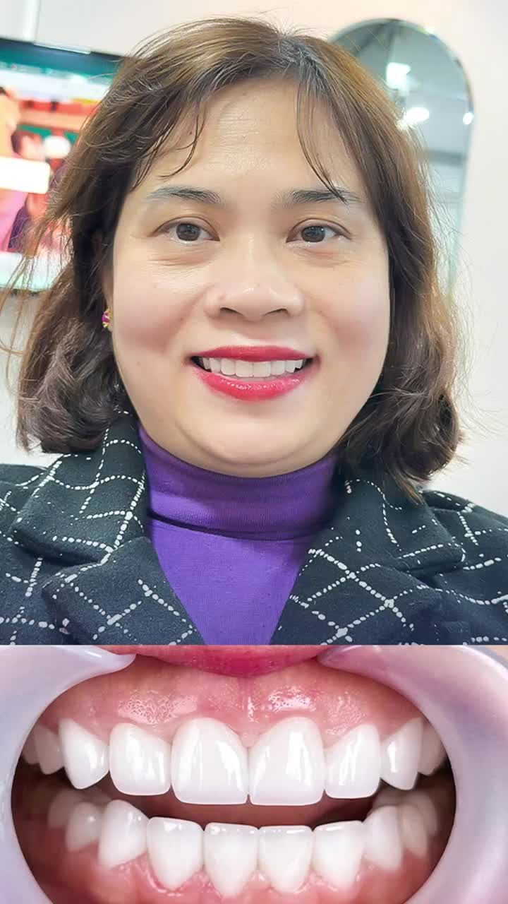 RĂNG SỨ THẨM MỸ - NỤ CƯỜI TỰ TIN, RẠNG RỠ