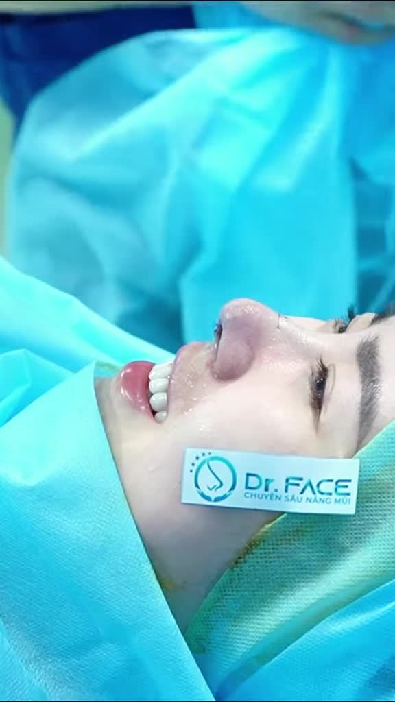 Xinh rồi… nhưng nâng mũi xong còn xinh hơn nữa!