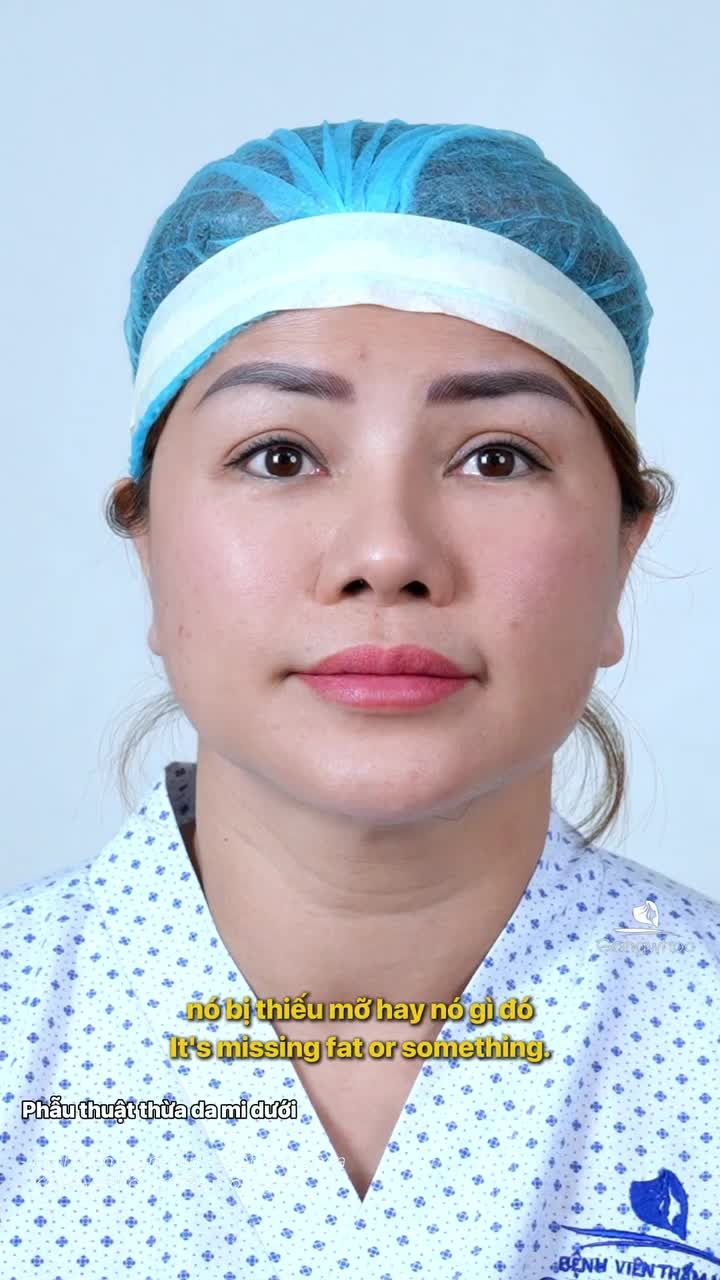 Các khuyết điểm vùng mí dưới đã được cải thiện rõ rệt. Khách hàng cảm thấy thoải mái trong suốt quá trình, tình trạng sưng bầm được hạn chế tối đa.