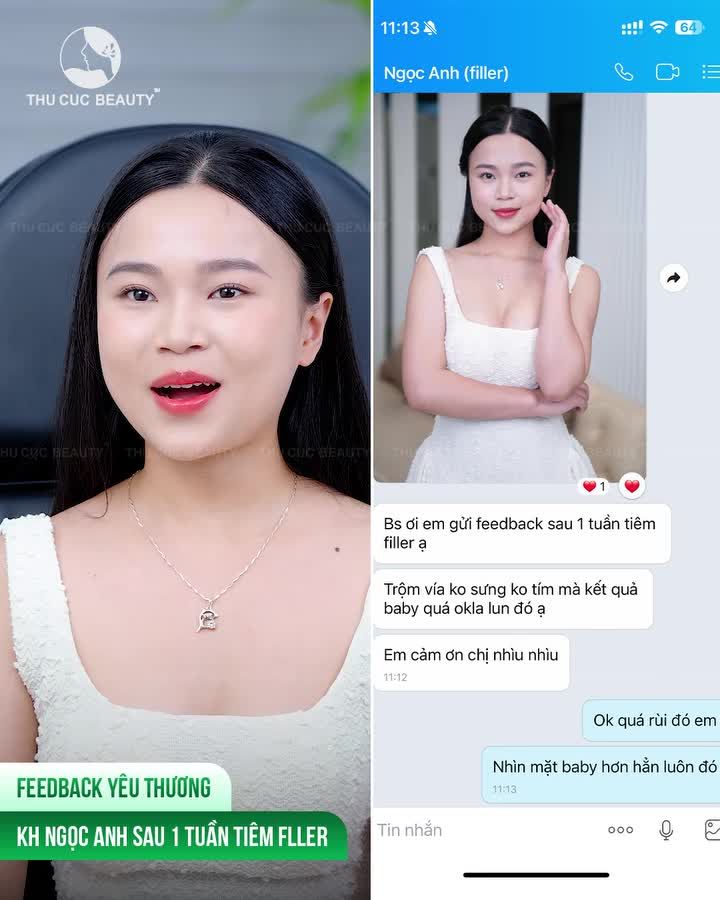 Trăm nghe không bằng 1 kết quả thật sau khi tiêm.