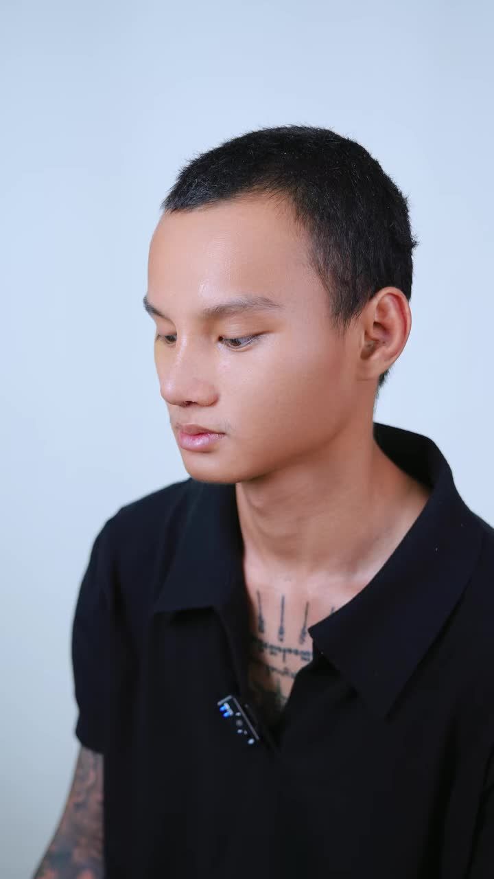 TÁI KHÁM NÂNG MŨI: CẬN CẢNH MÀN PHỤC HỒI DÁNG MŨI CHẤN THƯƠNG CHO DIỄN VIÊN ĐÓNG THẾ THÁI LAN!