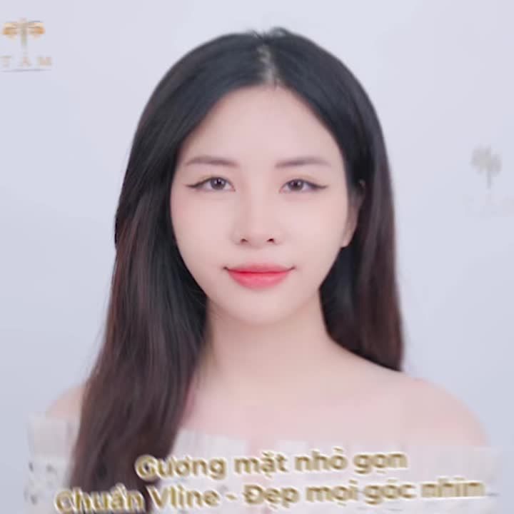 Khách hàng Kiều Trinh chia sẻ: “ Khi mà hàm em nhỏ lại thì em thấy lên hình, video e không phải bóp mặt nữa”. Sự hài lòng của khách hàng là động lực to lớn cho TMV Tấm.