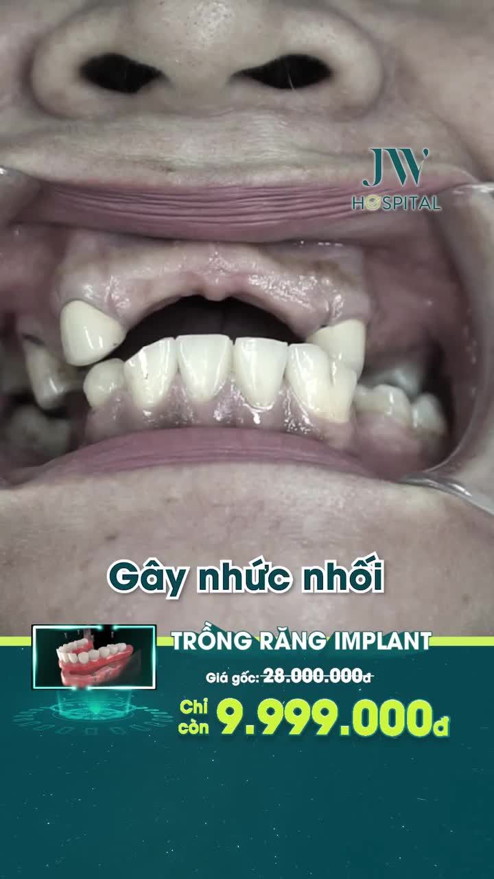 SANG TRỌNG, TỰ TIN CÙNG QUÝ CÔ U60 BẰNG TRỒNG RĂNG IMPLANT TẠI JW