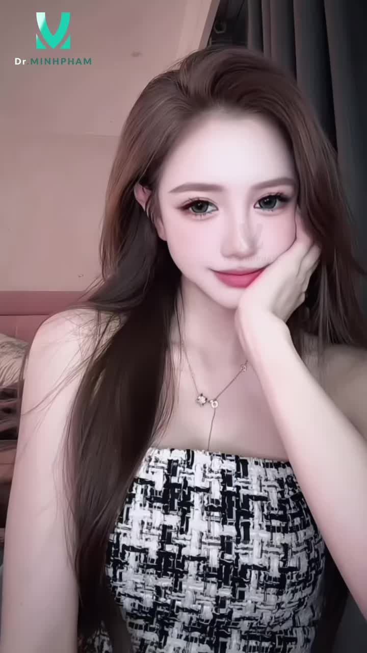 Feedback từ chị đẹp sau hơn 1 năm thực hiện mở góc mắt ngoài tại Dr. Minh Phạm