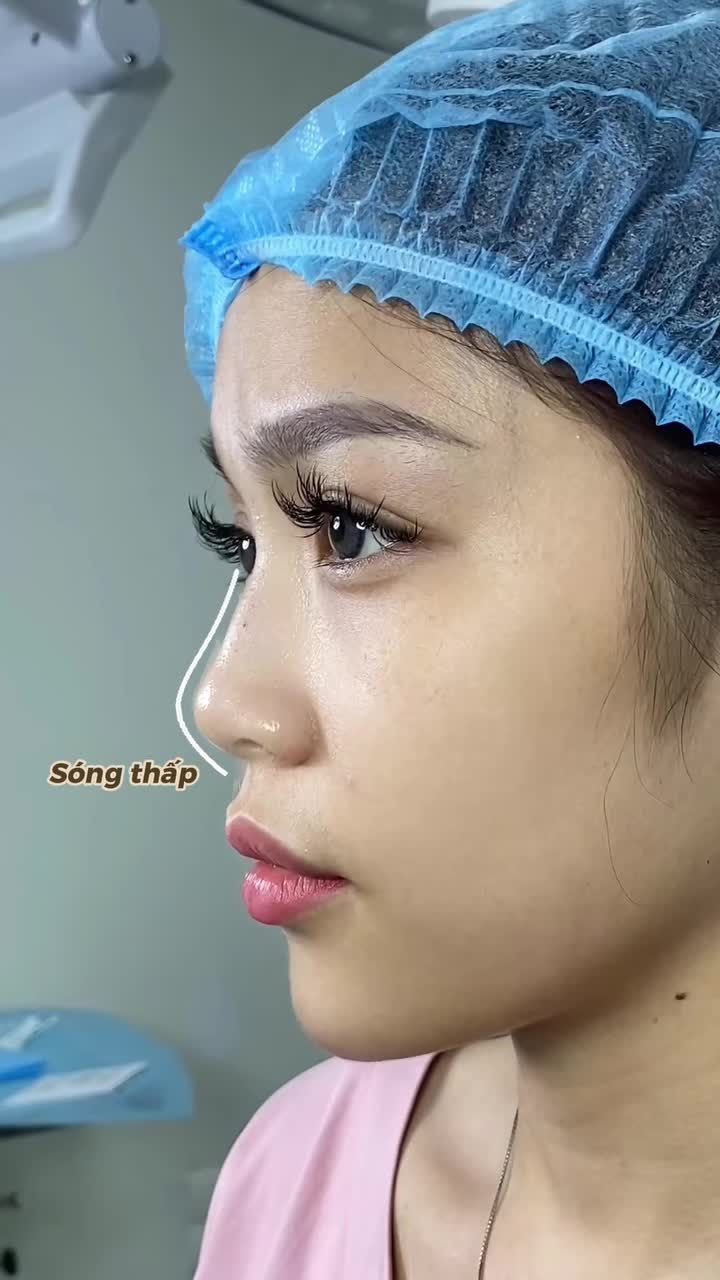 Chỉ sau 45 phút, mũi đẹp tự nhiên, không cần dùng app - bí quyết mà bạn không nên bỏ qua.