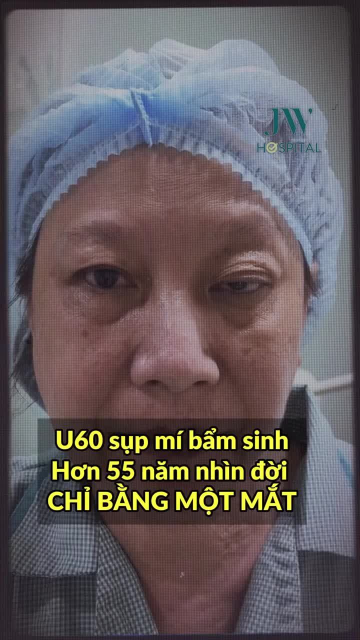 XÓT XA: HƠN 55 NĂM NHÌN ĐỜI BẰNG MỘT MẮT, NGƯỜI PHỤ NỮ U60 TÌM ĐƯỢC ÁNH SÁNG CUỐI ĐỜI TẠI JW