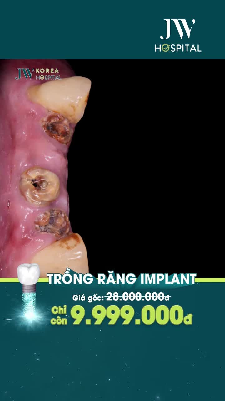 HẾT ÁM ẢNH MẤT RĂNG: PHỤC HÌNH IMPLANT ALL ON 4 VIỆT KIỀU U70 CÓ RĂNG ĂN NHAI, BỀN ĐẸP TRỌN ĐỜI