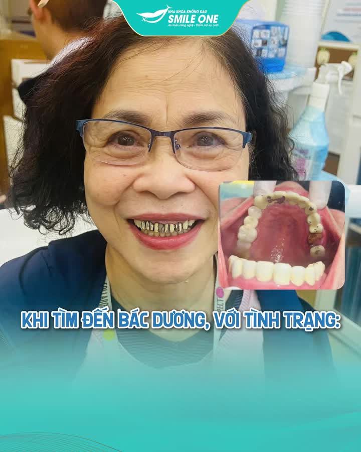 Đừng để "nụ cười đẹp" trở thành nỗi ám ảnh dài hạn