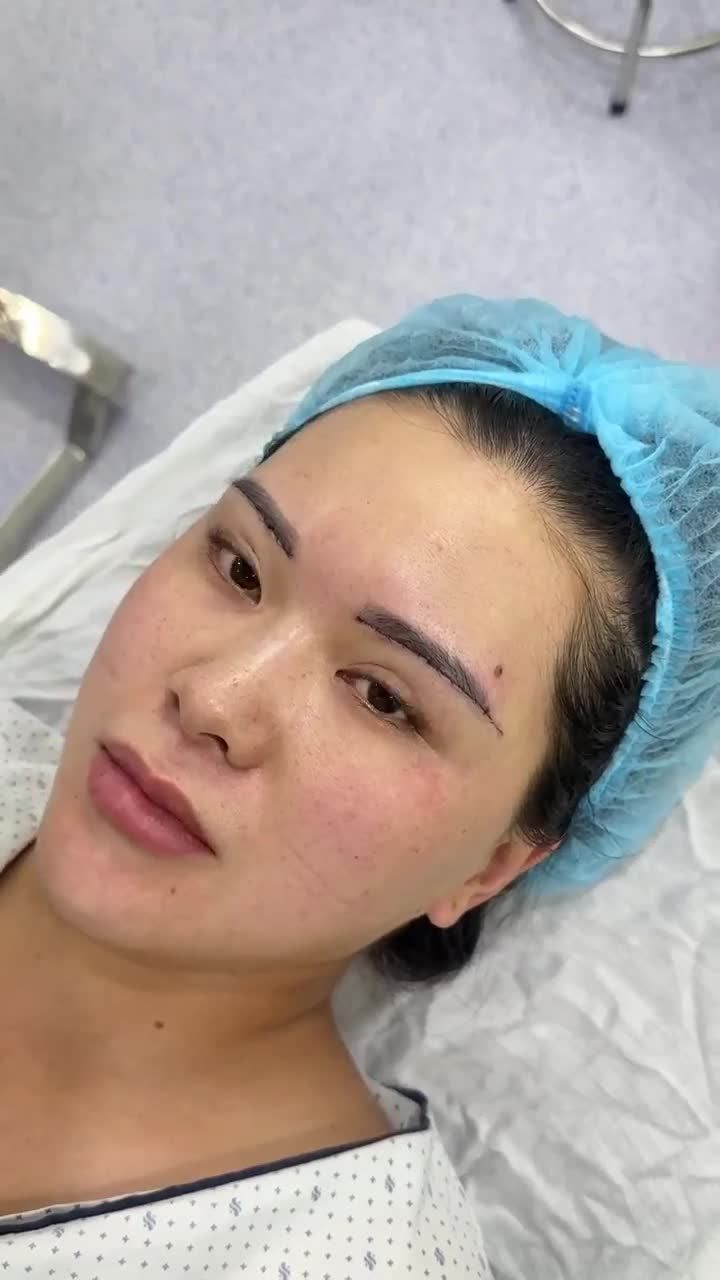 KẾT QUẢ SAU 60 PHÚT TREO CUNG CHÂN MÀY