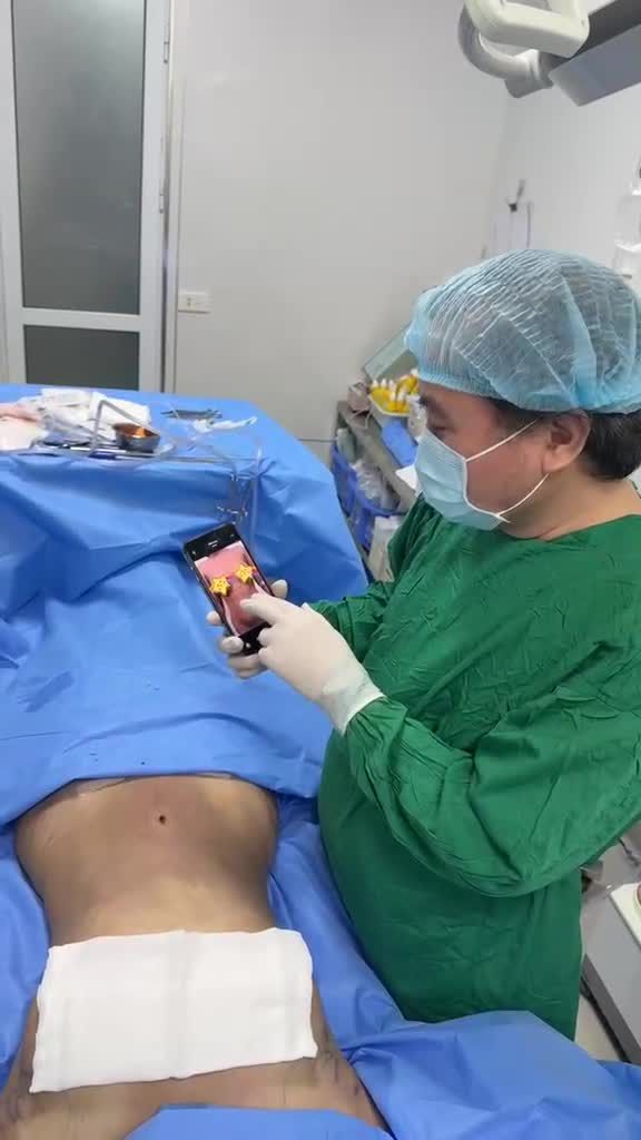 Hút tuyến vú phụ, hút mỡ nách hút mỡ bụng !