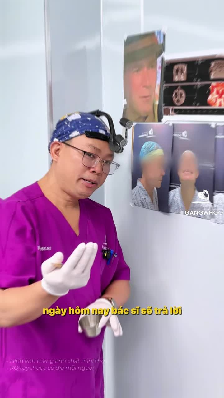 Vì sau trước nâng mũi phải chụp X-Quang AI điện toán