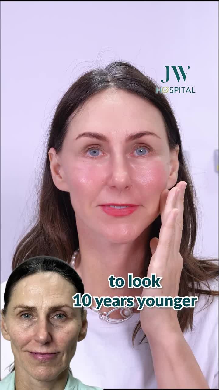 NHÌN TRẺ RA HƠN 10 TUỔI VỚI CẤY MESO COLLAGEN TẠI JW – NGƯỜI PHỤ NỮ ĐỨC 60 TUỔI ĐÃ TRẢI NGHIỆM KẾT QUẢ