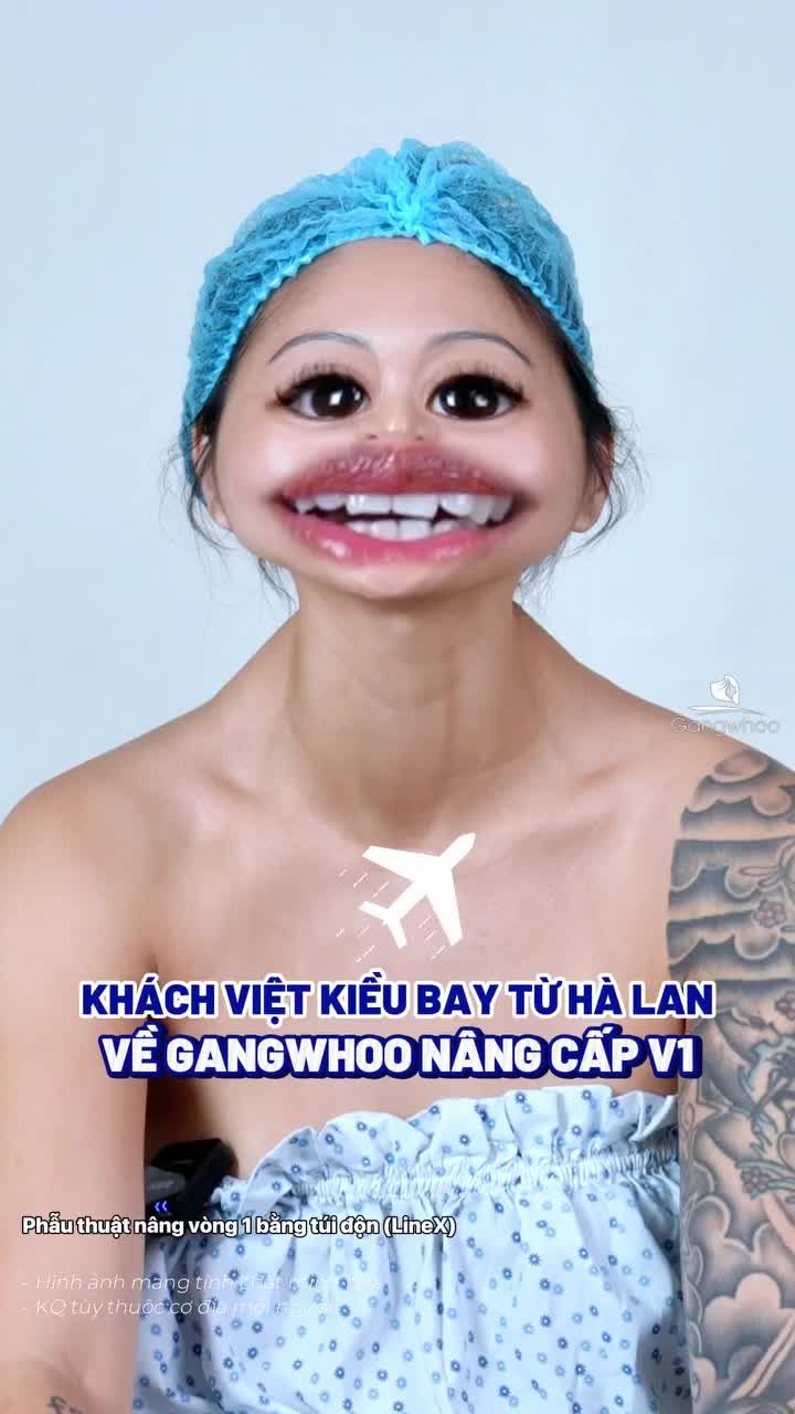 Chị khách Việt Kiều từ Hà Lan cùng mẹ bay thẳng về Gangwhoo để tìm lại dáng ngực thời thanh xuân.