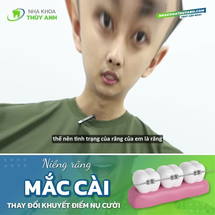 BẠN BÈ KHÔNG MỘT AI NGHĨ EM LẠI ĐI NIỀNG RĂNG…