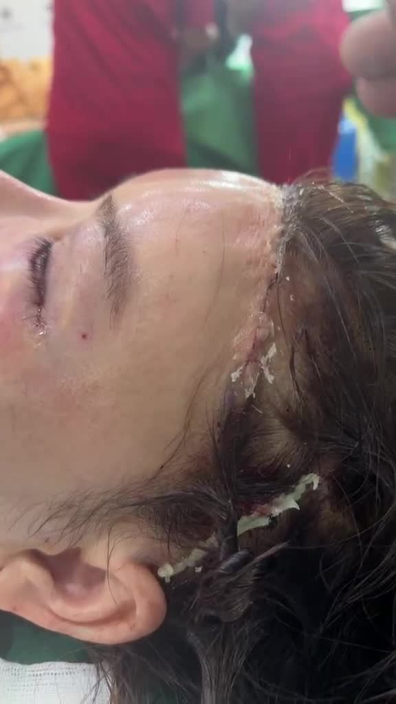 Siêu combo của Dr Vương cho bạn gái Việt kiều :