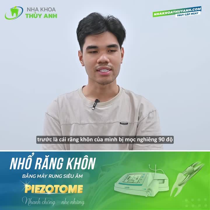 TRANH THỦ VỀ VIỆT NAM PHẢI QUA NGAY THÙY ANH NHỔ RĂNG KHÔN SỚM
